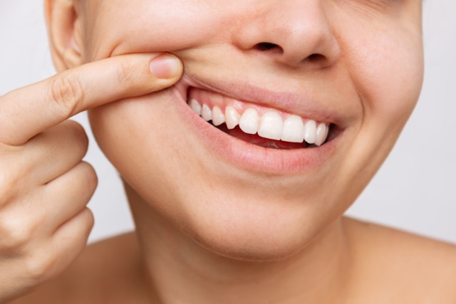 FSA and HSA Dental Care Guide